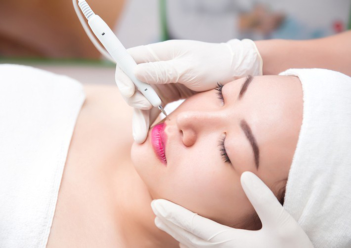 Máy Đốt Nốt Ruồi